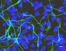 Read more about the article Laser-assisted derivation