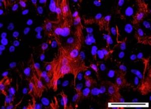 Read more about the article Derivation of xeno-free and GMP- grade