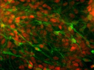 Read more about the article Derivation, propagation, and controlled differentiation of human embryonic stem cells in suspension